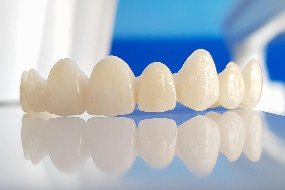 Zirconia Crowns in India: Exploring Cost and Benefits with AMD Dental Clinic in Jaipur 