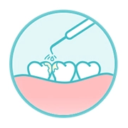 Cosmetic dentistry | Teeth cleaning at AMD Dental Clinic