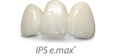 IPS Emax dental crowns with 15 years warranty for front teeth