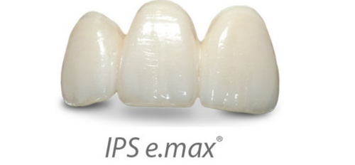 IPS Emax dental crowns with 15 years warranty for front teeth 