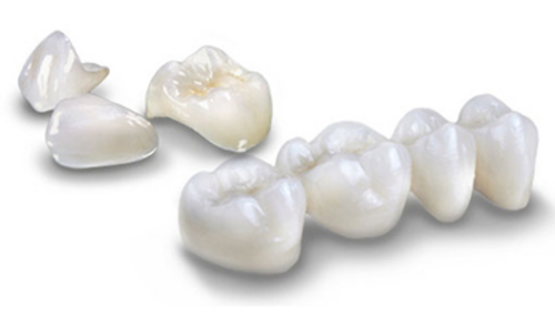 Best dental crowns with 15 years brand warranty from 3M lava zirconia