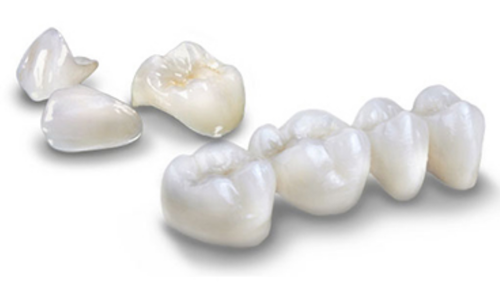 Best dental crowns with 15 years brand warranty from 3M lava zirconia 