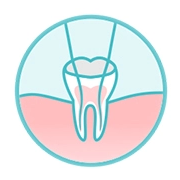 Root Canal Treatment | RCT at AMD Dental Clinic